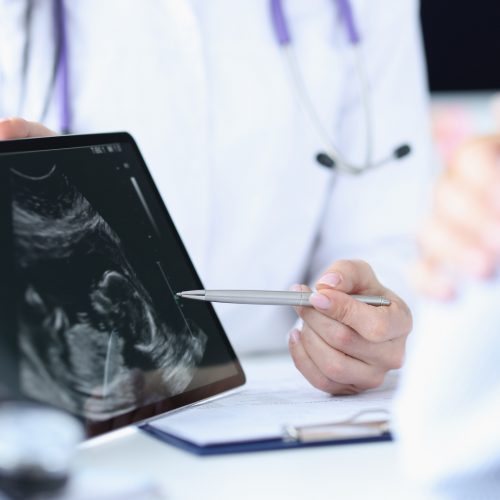Doctor demonstrates fetal ultrasound on tablet screen. Medical examination during pregnancy concept